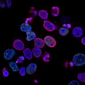 Looking for Bioinformaticians for Drug Repurposing Project